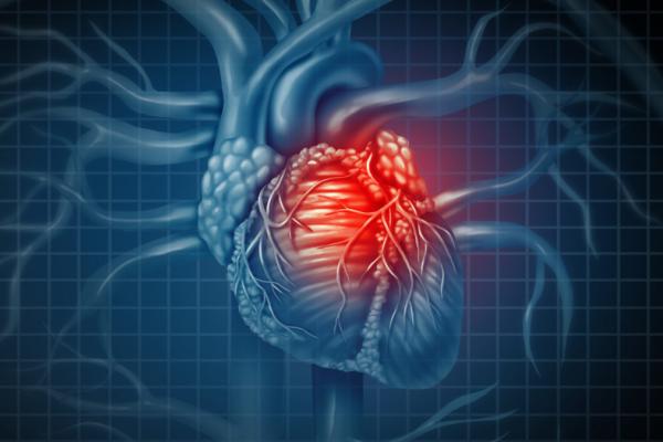 Noninvasive Modeling Technology Aims to Better Assess Risk of Heart Attack